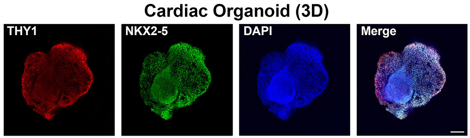 Shown is the 3D cardiac organoid model that the research team developed.